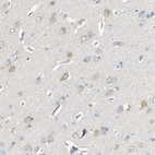 Immunohistochemical staining of human cerebral cortex shows weak cytoplasmic positivity in neurons.