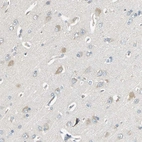 Immunohistochemical staining of human cerebral cortex shows weak cytoplasmic positivity in neurons.