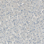 Immunohistochemical staining of human liver shows no positivity in hepatocytes as expected.