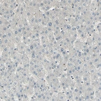 Immunohistochemical staining of human liver shows no positivity in hepatocytes as expected.