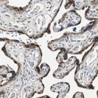 Immunohistochemical staining of human placenta shows strong cytoplasmic positivity in trophoblastic cells.