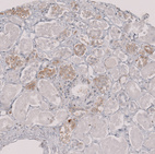 Immunohistochemical staining of human kidney shows moderate cytoplasmic positivity in cells in tubules.