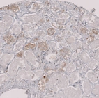 Immunohistochemical staining of human kidney shows moderate cytoplasmic positivity in cells in tubules.