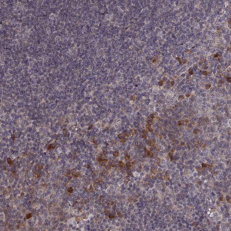 Anti-USP15 Antibody