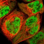 Immunofluorescent staining of human cell line A-431 shows localization to nucleoplasm.
