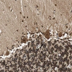 Immunohistochemical staining of human cerebellum shows moderate to strong cytoplasmic and nuclear positivity in Purkinje cells.