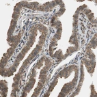 Immunohistochemical staining of human fallopian tube shows weak to moderate cytoplasmic positivity in glandular cells.