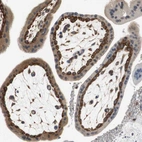Immunohistochemical staining of human placenta shows moderate to strong cytoplasmic positivity in cytotrophoblast.