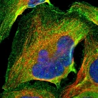Immunofluorescent staining of human cell line U-2 OS shows localization to plasma membrane & cytosol.
