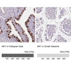 Anti-AK1 Antibody