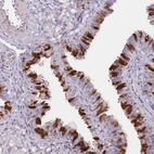 Immunohistochemical staining of human fallopian tube shows high expression.