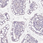 Immunohistochemical staining of human small intestine shows low expression as expected.