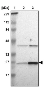 Lane 1: Marker [kDa] 229, 112, 84, 48, 32, 27, 17_br/_Lane 2: Human cell line RT-4_br/_Lane 3: Human cell line U-251MG sp