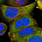 Immunofluorescent staining of human cell line A-431 shows localization to cytosol.