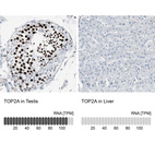 Anti-TOP2A Antibody