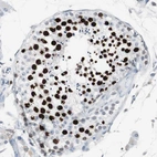 Immunohistochemical staining of human testis shows strong nuclear positivity in cells in seminiferous ducts.