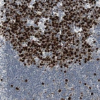 Immunohistochemical staining of human lymph node shows strong nuclear positivity in germinal center cells.