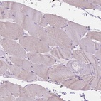 Immunohistochemical staining of human skeletal muscle shows low expression as expected.