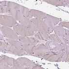 Immunohistochemical staining of human skeletal muscle shows low expression as expected.
