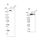 Western blot analysis using Anti-FASN antibody HPA006461 (A) shows similar pattern to independent antibody HPA056108 (B).