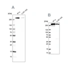 Western blot analysis using Anti-FASN antibody HPA006461 (A) shows similar pattern to independent antibody HPA056108 (B).
