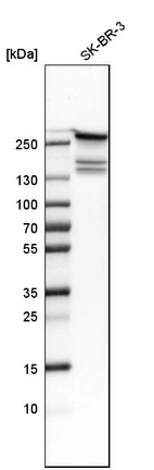 Western blot analysis in human cell line SK-BR-3.