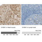 Anti-S100A1 Antibody
