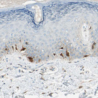 Immunohistochemical staining of human skin shows moderate to strong cytoplasmic positivity in melanocytes.