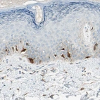 Immunohistochemical staining of human skin shows moderate to strong cytoplasmic positivity in melanocytes.