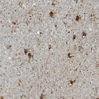 Immunohistochemical staining of human cerebral cortex shows strong cytoplasmic positivity in neurons.