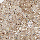 Immunohistochemical staining of human heart muscle shows moderate to strong nuclear positivity in cardiomyocytes.