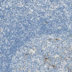Anti-S100A1 Antibody