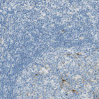 Immunohistochemical staining of human lymph node shows no positivity in non - germinal center cells as expected.
