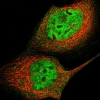 Immunofluorescent staining of human cell line A-431 shows localization to nucleoplasm & cytosol.