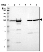 Lane 1: Marker [kDa] 230, 130, 95, 72, 56, 36, 28, 17, 11_br/_Lane 2: Human cell line RT-4_br/_Lane 3: Human cell line U-251MG sp_br/_Lane 4: Human plasma (IgG/HSA depleted)_br/_Lane 5: Human liver tissue_br/_Lane 6: Human tonsil tissue