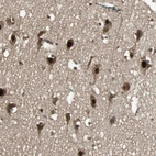 Immunohistochemical staining of human cerebral cortex shows strong nuclear and cytoplasmic positivity in neurons.