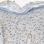 Immunohistochemical staining of human skin shows moderate nuclear positivity in squamous epithelial cells.