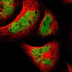 Immunofluorescent staining of human cell line A-431 shows localization to nucleoplasm.