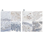 Immunohistochemical staining of human cervix, uterine, skeletal muscle, skin and small intestine using Anti-CPA3 antibody HPA006479 (A) shows similar protein distribution across tissues to independent antibody HPA008689 (B).