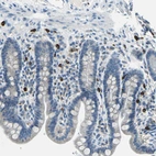 Immunohistochemical staining of human small intestine shows moderate to strong cytoplasmic positivity in mast cells.