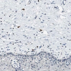 Immunohistochemical staining of human cervix, uterine shows moderate to strong cytoplasmic positivity in mast cells.