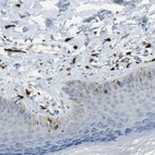 Immunohistochemical staining of human skin shows moderate to strong cytoplasmic positivity in mast cells.