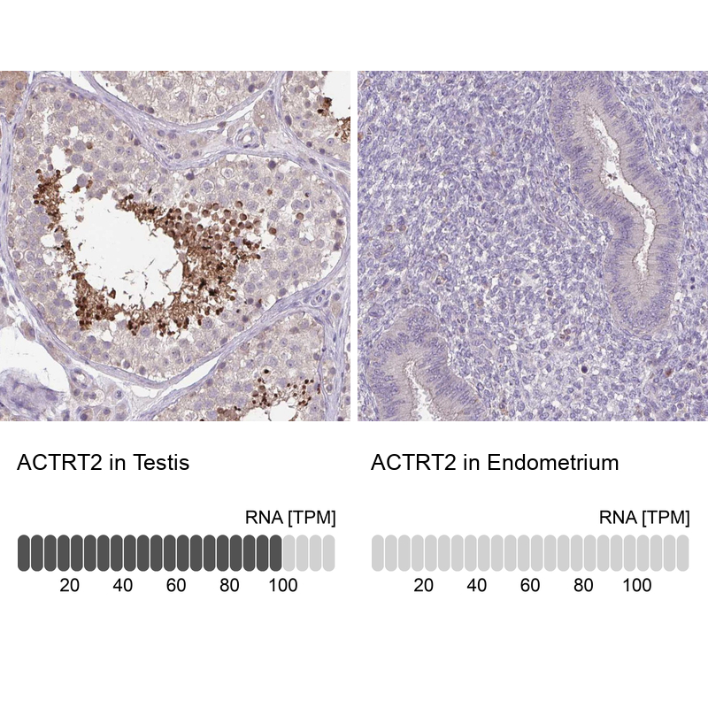 Anti-ACTRT2 Antibody
