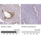 Anti-ACTRT2 Antibody