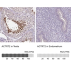 Anti-ACTRT2 Antibody