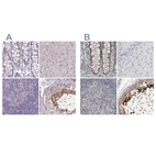 Immunohistochemical staining of human colon, liver, lymph node and testis using Anti-ACTRT2 antibody HPA006480 (A) shows similar protein distribution across tissues to independent antibody HPA025079 (B).