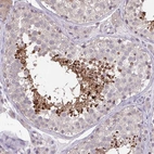 Immunohistochemical staining of human testis shows high expression.