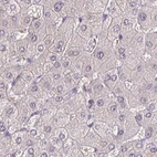 Immunohistochemical staining of human liver using Anti-ACTRT2 antibody HPA006480.