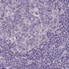 Immunohistochemical staining of human lymph node using Anti-ACTRT2 antibody HPA006480.