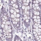 Immunohistochemical staining of human colon using Anti-ACTRT2 antibody HPA006480.